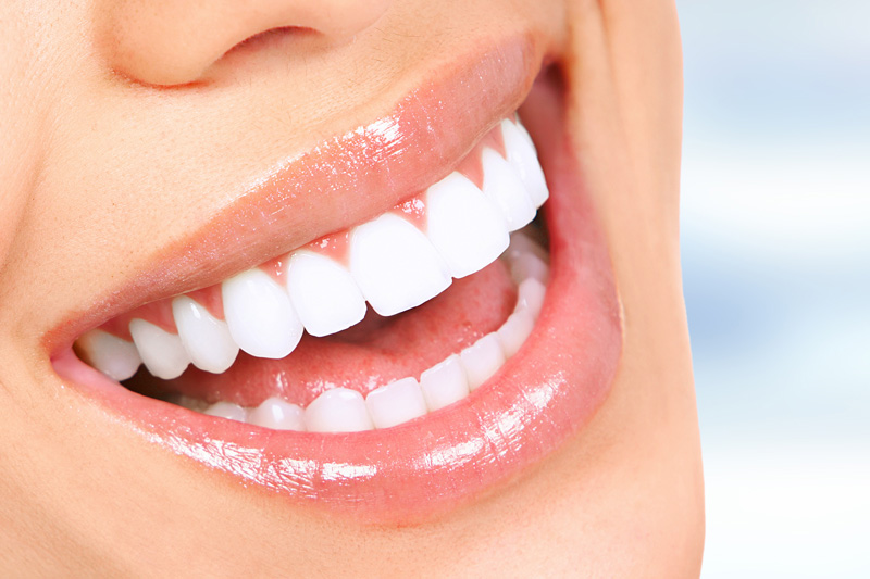 Cosmetic Dentistry in Odessa